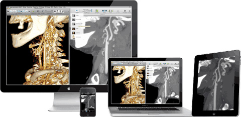 teleradiology ipad app teleradiology ipad app